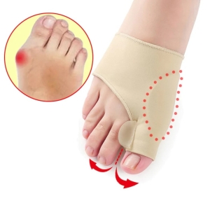 Geelside varbale Hallux